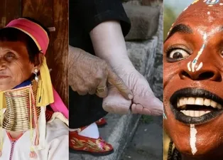 O ülkelerde güzelliğin bedeli ağır: İşte tarihe geçen sıra dışı uygulamalar