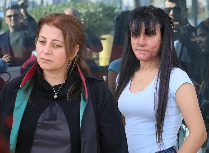 Yüzüne asit döken Casim Ozan Çeltik'i affeden Berfin Özek: Kandırılmış olsam yardım isterdim - 2