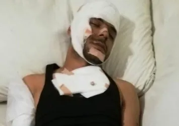 Kendisine "öldü" süsü verip Facebook'ta paylaştırdı