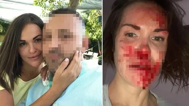 Ankara’da lüks sitede ölü bulunan Rus kadının “düşüp öldüğü” şüphesi üzerinde duruluyor - 5