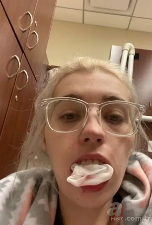 Herkes aynı hatayı yapıyor! 23 yaşında bütün dişleri döküldü 3