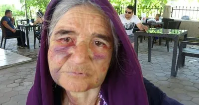 Adana’da dehşete düşüren olay! Yaşlı kadını darp eden adamın sözleri pes dedirtti