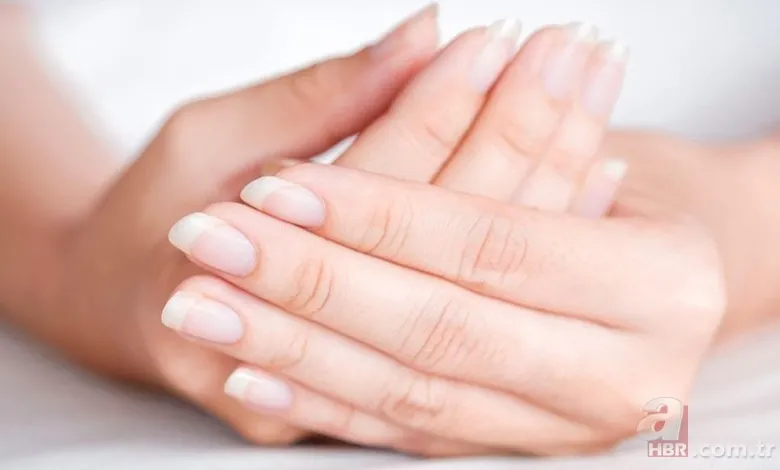 Tırnak diplerinizi kontrol edin! Belki de bu hastalıklardan birine sahipsiniz... 6