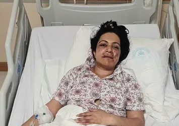 Eltilerin güzellik kavgası kanlı bitti! Ağzından silahla vurdu