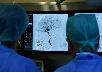 "Beyin sisi" bu belirtilerle ortaya çıkıyor!