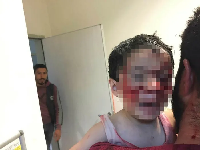 Şanlıurfa'da sokakta dehşet! 6 çocuk kanlar içerisinde kaldı, 3'ünün durumu ağır - 3