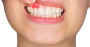 Bu hatalar diş minesine zarar veriyor!