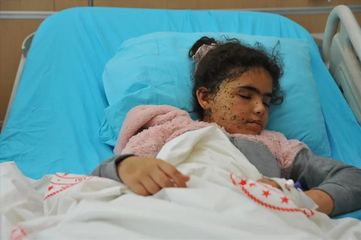 Tel Abyad'da PKK'nın döşediği mayın patladı 1 çocuğun bacağı kesildi - 3