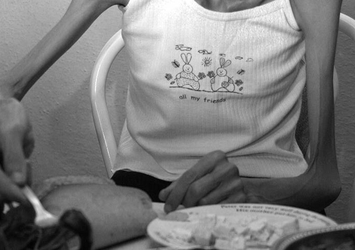 Kilo kaybı değil ruhsal çöküş: "Anoreksiya"