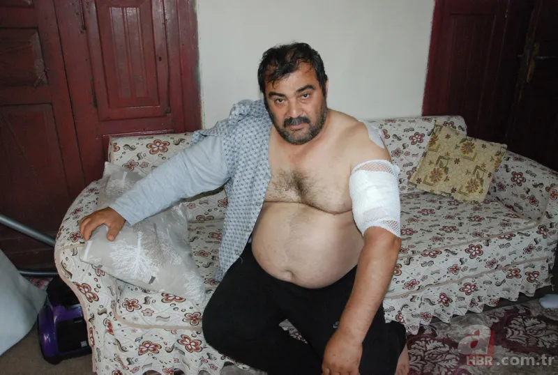 Bartın'da ayı saldırısı! 65 dikiş atıldı: Öldüğümü sanıp bıraktı 4