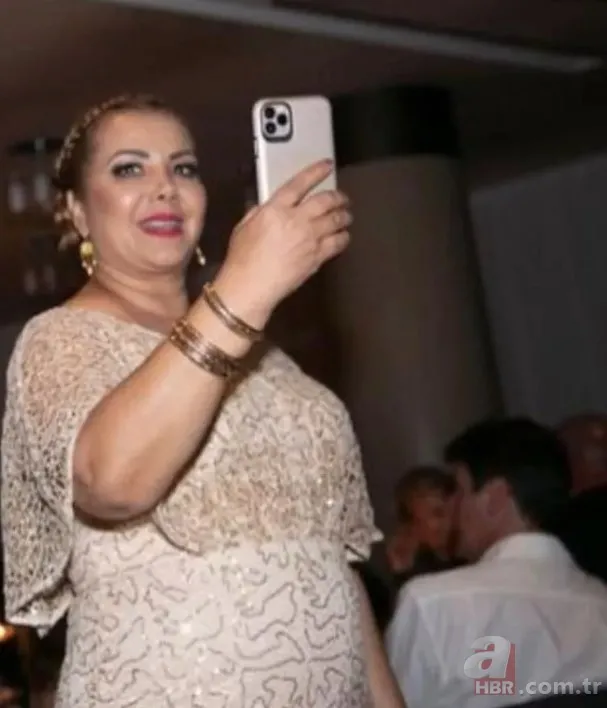 Tartıda 99’u görünce soluğu mide küçültme ameliyatında almıştı! Tanyeli’nin yeni hali görenleri şoke etti 3