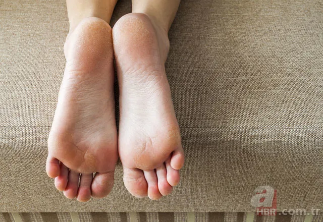 Ciddi sağlık sorunları belirtisi 9 ayak rahatsızlığı 7