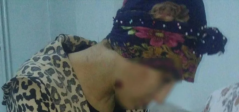 Gaziantep'te eski koca dehşeti! Her satırı kan dondurdu