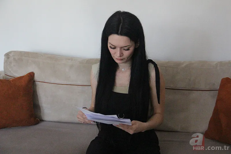 Güzellik merkezinde facia! Solaryum cihazında unutuldu: Vücudumda yanıklar oluştu 6