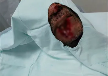 Öfkeli damat, sokak ortasında eşinin ailesine beyzbol sopalarıyla saldırdı