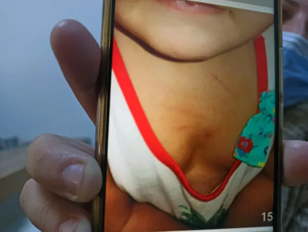 1612684868464.jpg Mersin'de kan donduran olay! Kreşteki şiddeti oyuncakla ortaya çıkardı - 1