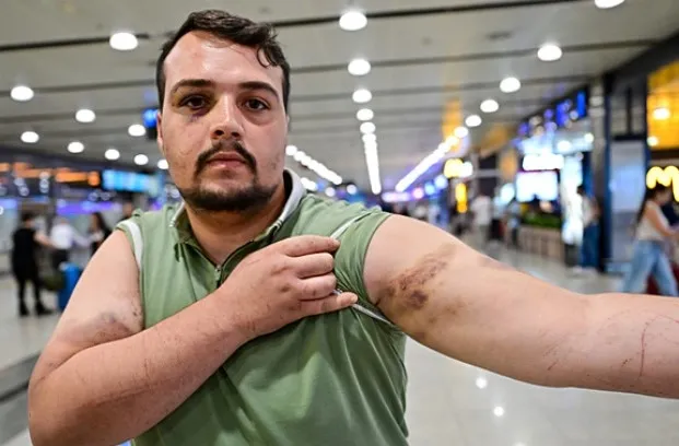 hirvatistanda-kacirilan-turk-vatandasi-yurda-dondu-yasadigi-o-anlari-anlatti-bakanligimiz-sayesinde-gelebildim-1723476254465.jpg Yurt dışında fidye için kaçırılan Türk vatandaşı İstanbul'a getirildi.