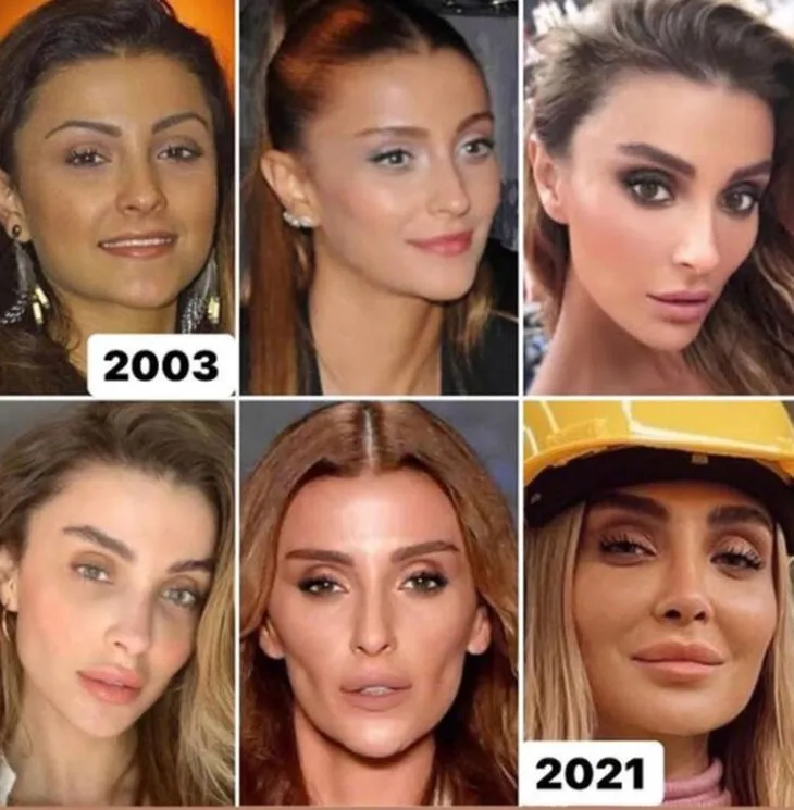 Burcu Ozberk Estetik Harikasi Cikti Eski Fotograflari Saskina Cevirdi Burcu Ozberk Estetik Harikasi Cikti Eski Fotograflari Saskina Cevirdi