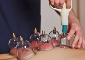 Ankara'da 'cin çıkarma' seansında feci şekilde can vermişti! O sanıkların cezası belli oldu