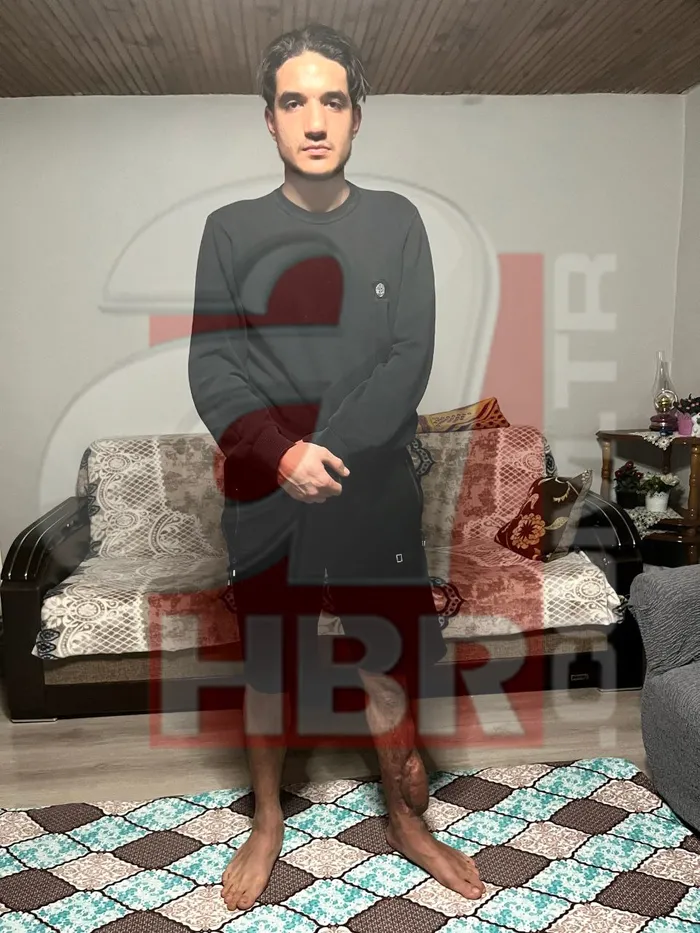 chp-ilce-baskaninin-carparak-sakat-biraktigi-genc-olayinin-perde-arkasi-o-genc-sadece-a-habere-anlatti-1767114633380.jpg CHP Üsküdar İlçe Başkanı’nın kendisine çarpması sonucu 8 ameliyat geçiren Hacı Resul Düzgün, ilk kez ahaber.com.tr’ye konuştu.