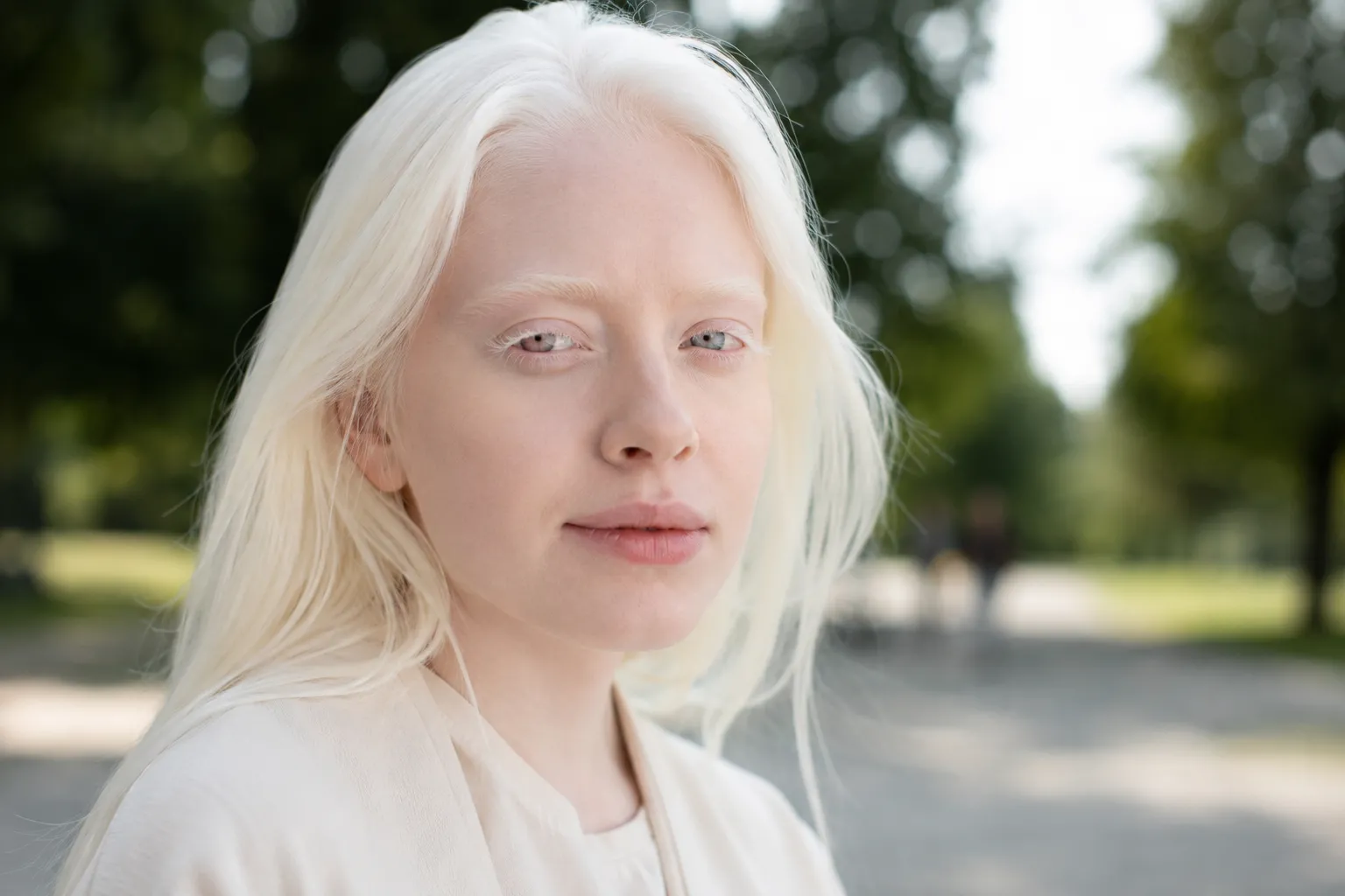 Albino nedir, neden olur? Albinizm türleri, belirtileri ve özellikleri
