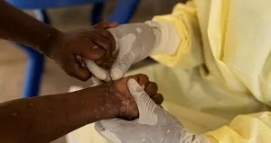 O ülkede 3 kişide M çiçeği virüsü tespit edildi!