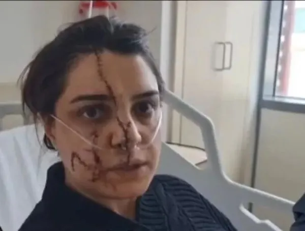 1710666970218.jpeg Marmaray'da güvenlik kadına bıçaklı saldırı! Yüzü paramparça oldu | O anlar kamerada - 3