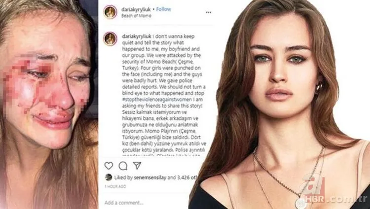 Ukraynalı manken Daria Kyryliuk saldırısında çifte şüphe! Polisler erkek arkadaşını teşhis etti 5