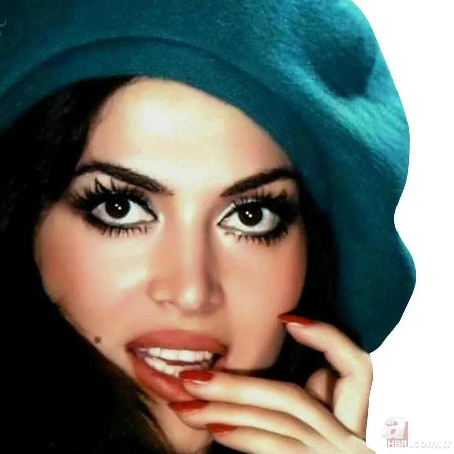 25 kilo veren Türkan Şoray'ın hastalığı belli oldu 2