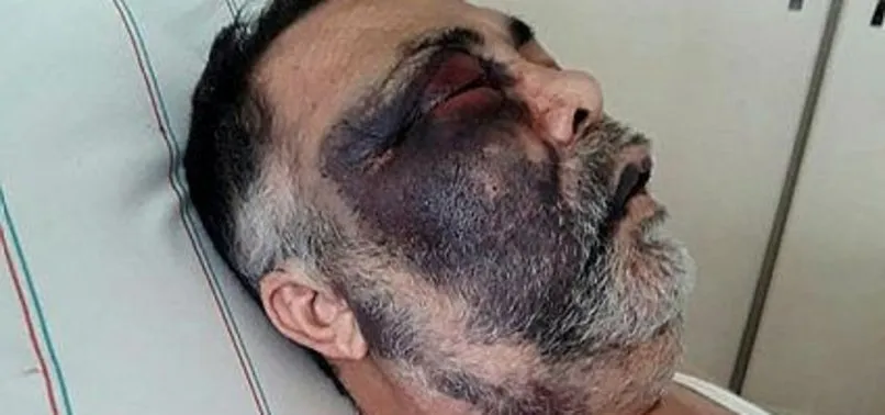 Antalya'daki vahşetten acı haber! Mümin Kara hayatını kaybetti!