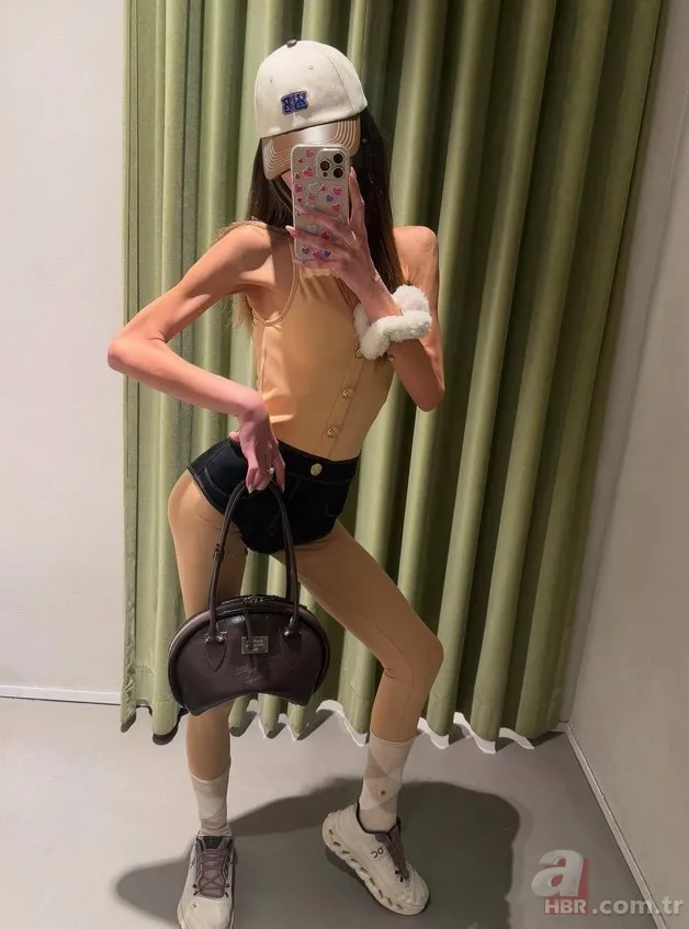 25 kiloya düşen Nihal Candan yoğun bakıma alındı: "Sağlık durumu kritik" 2