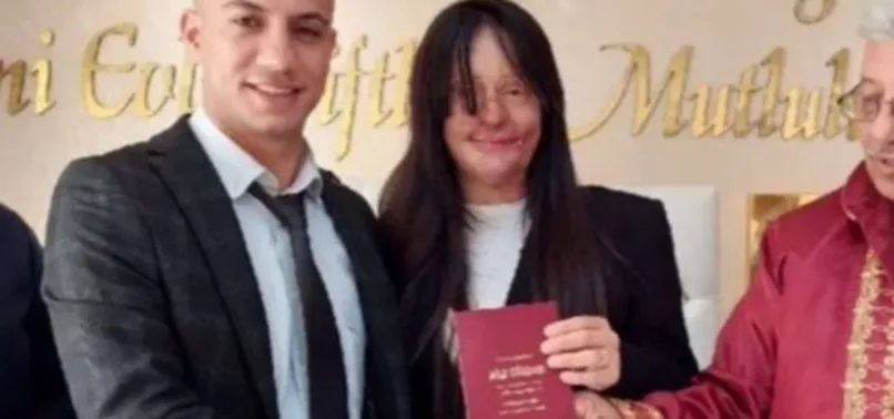 Berfin Özel sevgilisi kim? Asitle saldıran sevgilisiyle evlenen Berfin Özek kimdir, kaç yaşında, eski hali nasıl?