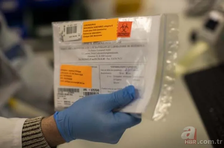 Hastanede yaşananlar tüyler ürpertti! İşte gün gün corona virüs kabusu 2