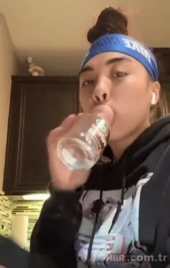 Fatih’te estetik yaptıran Bulgar modelin hayatı kabusa döndü! ‘Örümcek ağı’ operasyonu bakın ne hale getirdi? 12