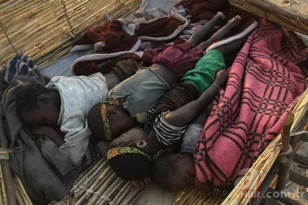 Dünyanın en tuhaf hastalıkları 22