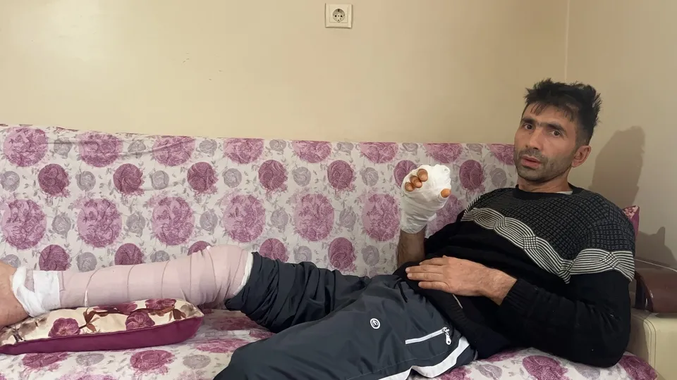 3 günde 3 farklı şehirde 3 olay! Komşusunun köpeği elini parçaladı ölümden döndü