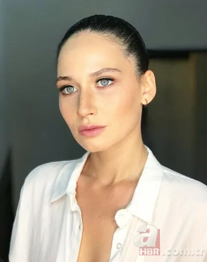 Kuzey Yıldızı İlk Aşk’ın Yıldız’ı Aslıhan Güner estetik harikası çıktı! Eski hali şoke etti! 2