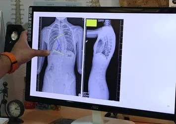 Çocuklarınızın kıyafetleri vücutlarına oturmuyorsa dikkat