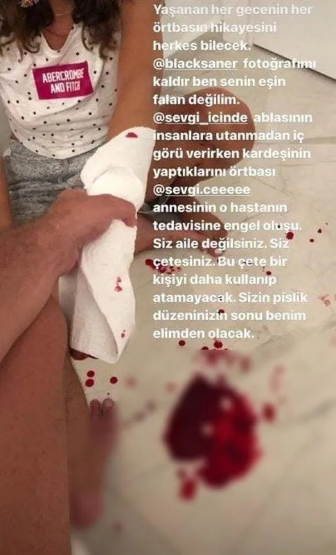 son-dakika-ayrildigi-esi-tarafindan-darbedilen-irem-ay-berkay-saner-icin-uzaklastirma-karari-aldirdi-1643985365721.jpg Berkay Saner şiddet fotoğraflarını paylaştı Türkiye ayağa kalktı! İrem Ay uzaklaştırma kararı aldırdı - 6