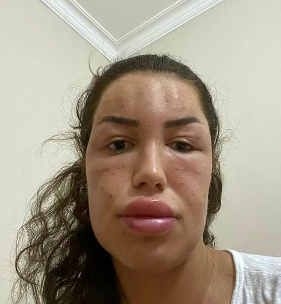 İzmir’de gençlik aşısı yaptıran Seline Ferah Çalışkan: Nefes alamadım - 6