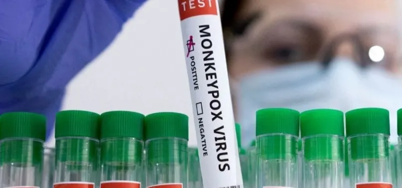 ABD'nin 7 eyaletinde "maymun çiçeği" virüsü alarmı