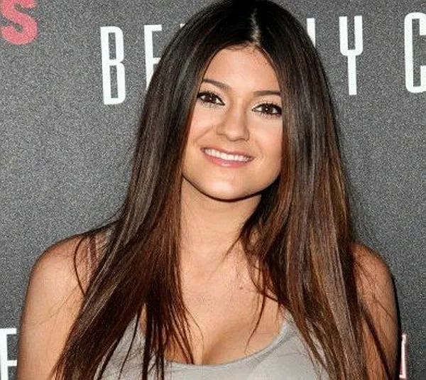 benim tatli yalanim in hande si gonca sariyildiz estetik harikasi cikti degisimi sok etti
