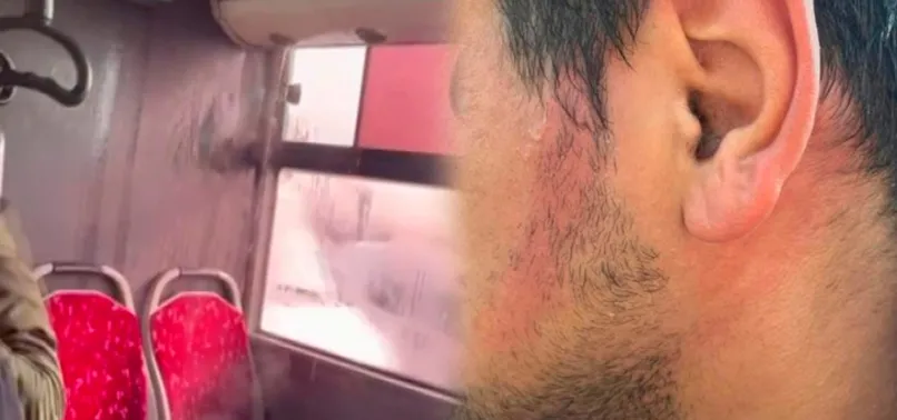 Akıllara durgunluk veren talihsizlik! Ümraniye’de İETT otobüsünün klima borusu patladı, yolcunun yüzü yandı