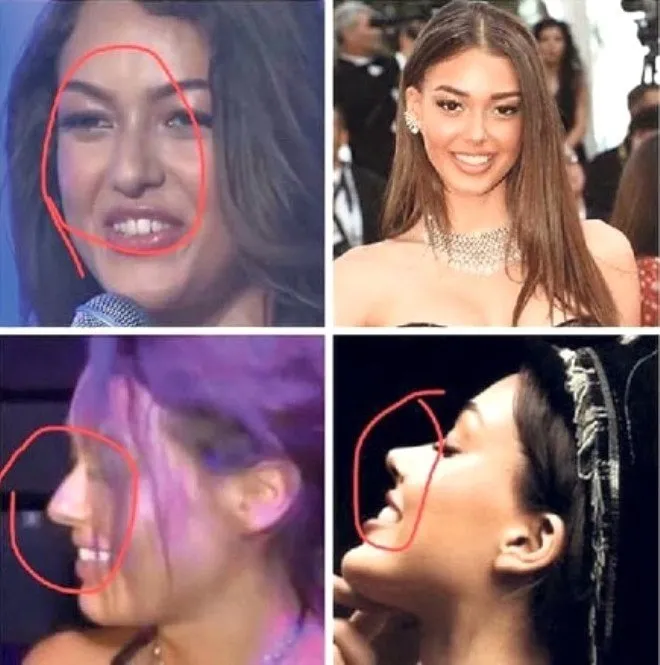 Burcu Ozberk Estetik Harikasi Cikti Eski Fotograflari Saskina Cevirdi Burcu Ozberk Estetik Harikasi Cikti Eski Fotograflari Saskina Cevirdi