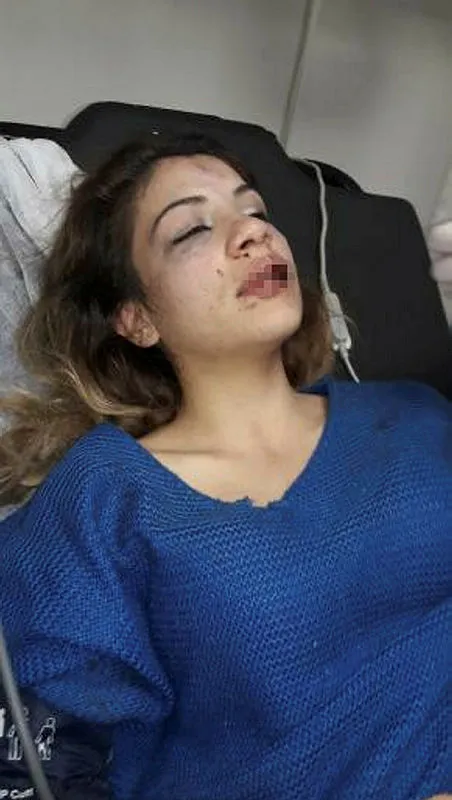 1669383319882.jpg Kocasının telefonunda 'babalık testi fiyatı' aramasını gördü! Çocuğunun yanında hamile kadını darbetti - 2