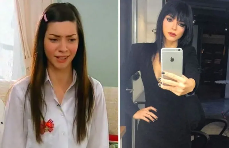 Zeynep Kocak In Son Hali Soke Etti Boyle Degisim Gorulmedi