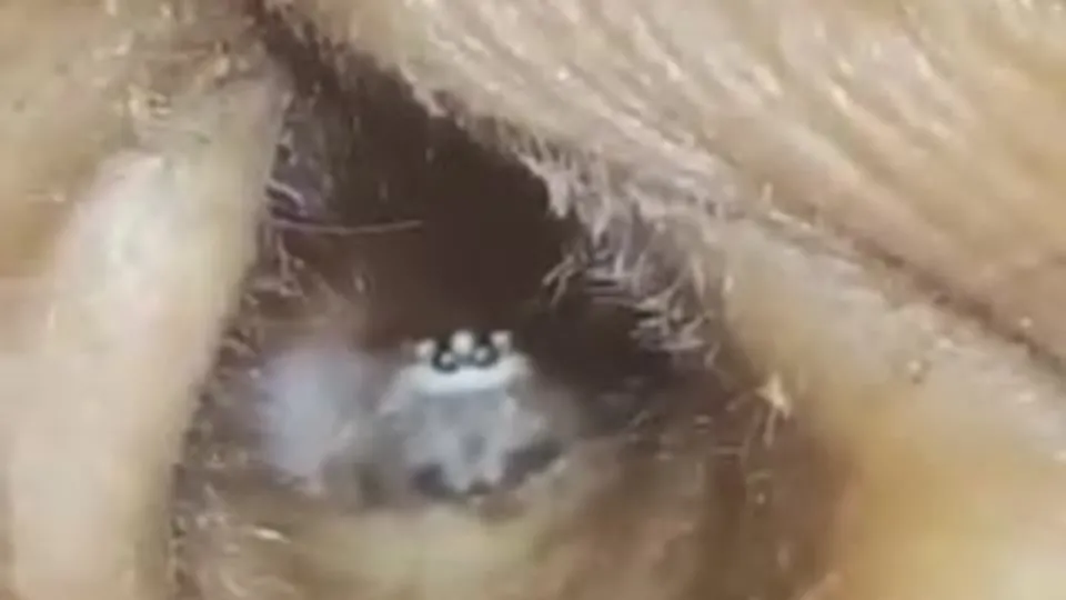 Kulağından çıkan dehşete düşürdü |Video