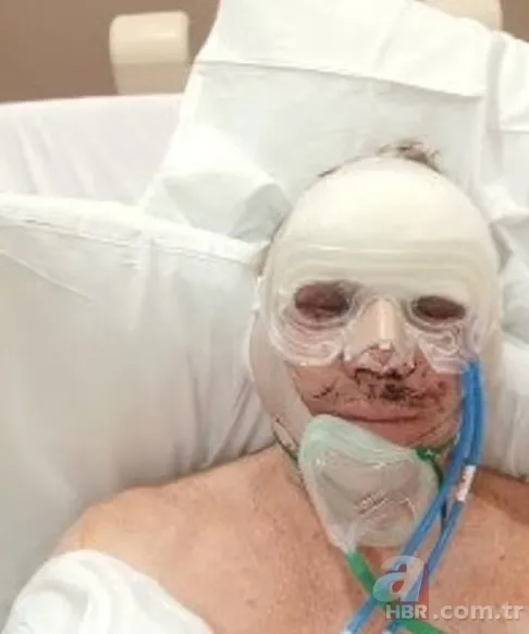 3 senedir gözlerini kapatamıyor! Sağlığına kavuşmak için Türkiye’ye geldi 6