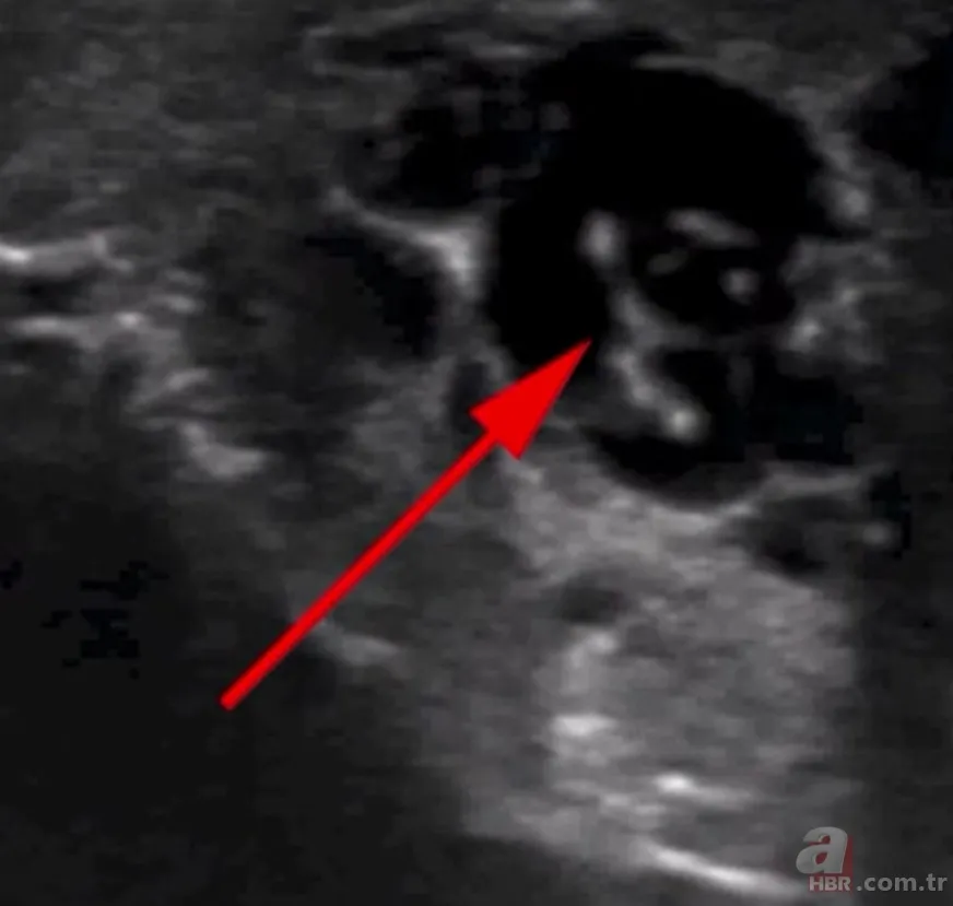 Doktora gitti hayatının şokunu yaşadı 👨⚕️ Sivrisinek ısırığı kabusu oldu 🦟 Dans eden düzinelerce... 9