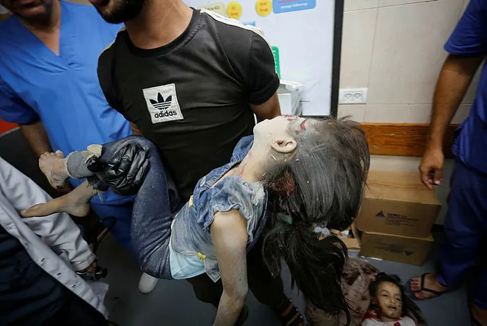 Katil İsrail’den Gazze’ye soykırım saldırısı: Onlarca şehit var | Türkiye’den sert tepki: Bu barbarlığa artık dur denmeli